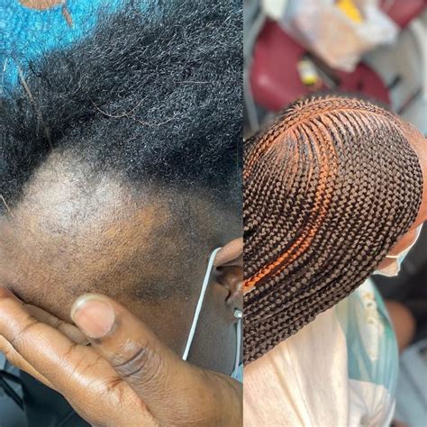 How to Hide Thin Edges with Braids - Forever Braids