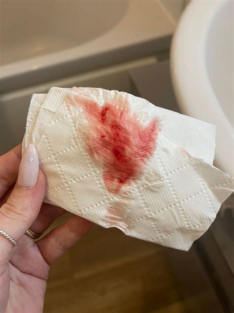 4 Weeks Pregnant Bleeding If You Have Similar Symptoms Don’t Be