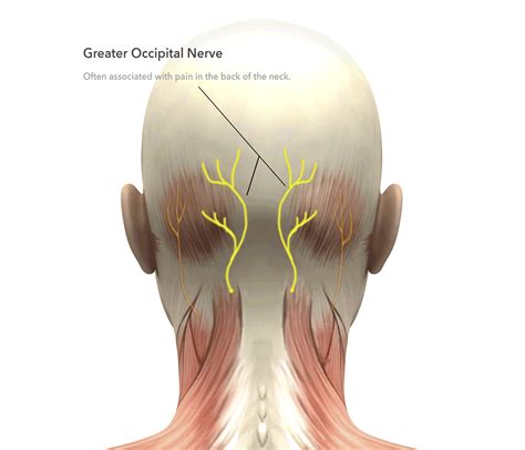 Greater Occipital Headache SciELO Brasil Massaging Over The Greater