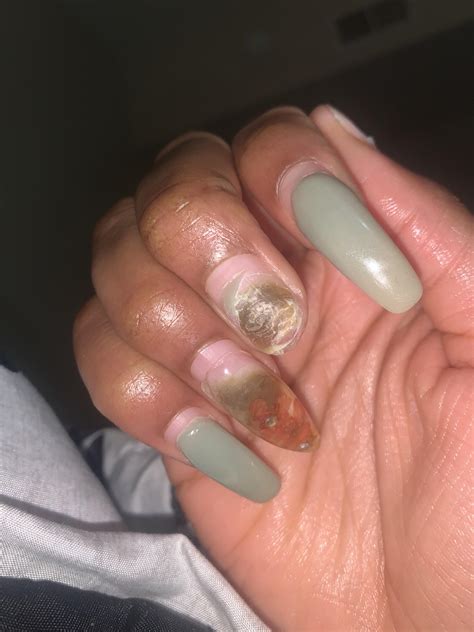 Fingernail Fungus From Acrylic Nails