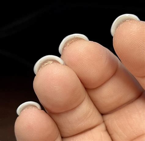 How to get rid of overgrown skin under the nail? Cant cut my nails ...