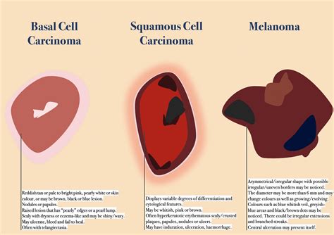 Skin Cancer Cells Vs Normal Cells