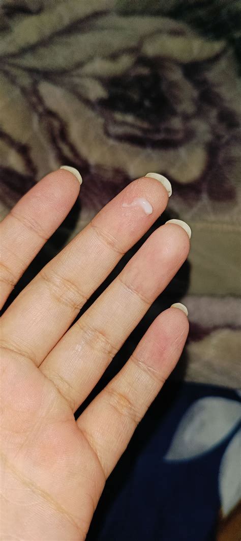 Early Pregnancy Discharge Does This Look Like Early Pregnancy