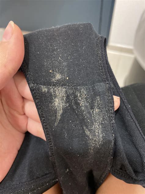 Is Crusty Discharge Normal at Tyson Walsh blog