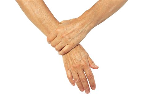 Premium Photo | Age spots on the hands of an elderly woman flabby senile skin dark brown pigment ...