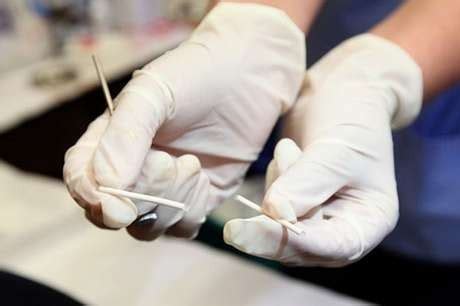 ArteSanos de la Salud: Implantes anticonceptivos subdérmicos