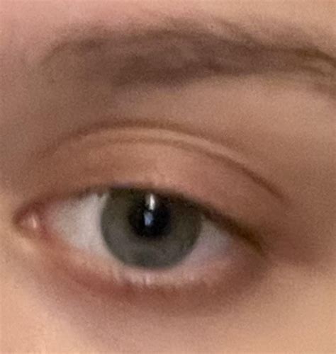 Extreme upper eyelid exposure : u/user493927729
