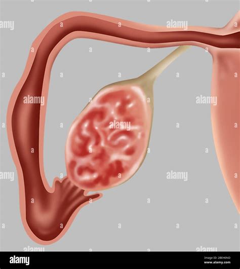 Human Anatomy Ovary And Fallopian Tube