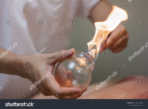 1,299 Fire Cup Therapy Images, Stock Photos & Vectors | Shutterstock