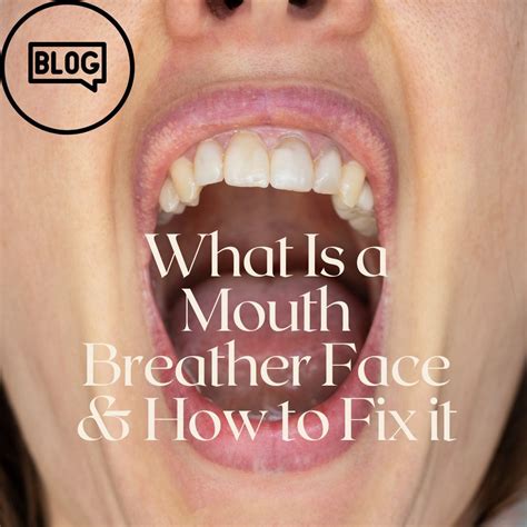 What is a mouth breather face how to fix it – Artofit