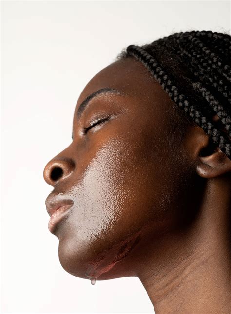 What are the symptoms of eczema on black skin?