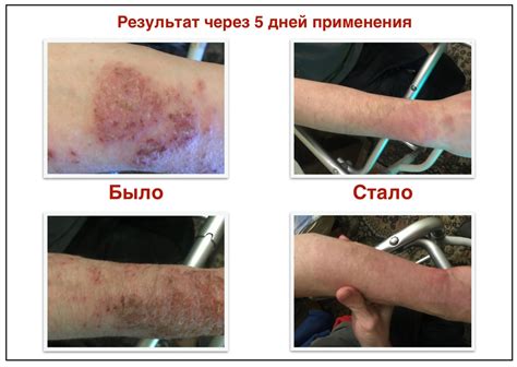 Статьи сообщества Главный Медицинский Канал | ВКонтакте