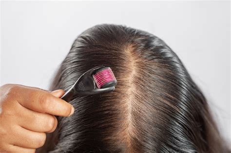 Best Treatments for Hair Loss Recommended By Doctors | First For Women