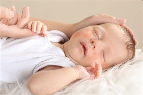 Do Babies Get Seasonal Allergies? - East TN Urgent Care