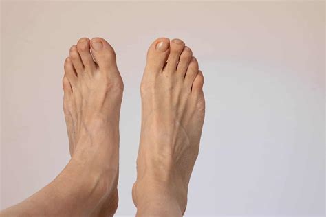 Extensor Tendonitis Feet