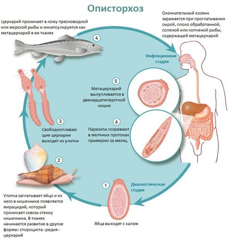Описторхоз: симптомы, лечение взрослых и детей, признаки, диагностика ...