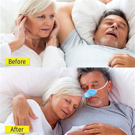 2021 Anti Snoring Device: 4-in-1 Atomization Snoring Solution with PM2.5 Filter - Adjustable ...