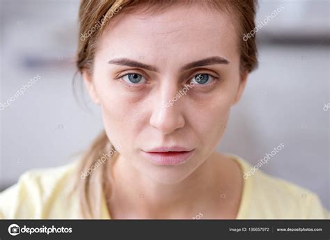 Anemic skin. Anemia Rash: Causes, Symptoms, and Effective Treatments Explained