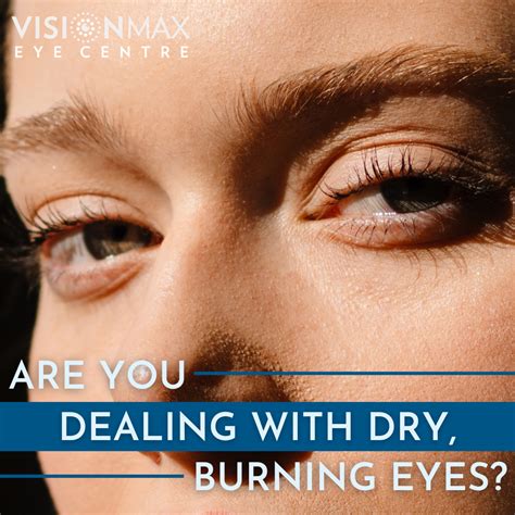 Dealing with dry burning eyes – Artofit