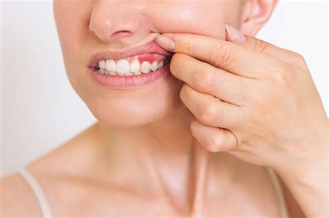 Why Is My Gum Swollen Around One Tooth? Causes and Treatments | Oral-B UK