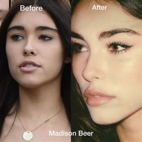 Madison Beer before and after plastic surgery natural without makeup ...