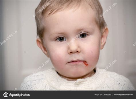 Cold Sores On Babies Lips | Lipstutorial.org