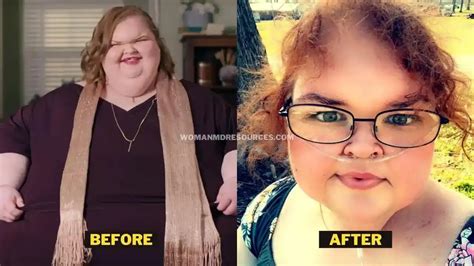 Tammy Slaton Weight Loss 2023. How 1000-lb Sisters' Star Lost 300 Pounds.