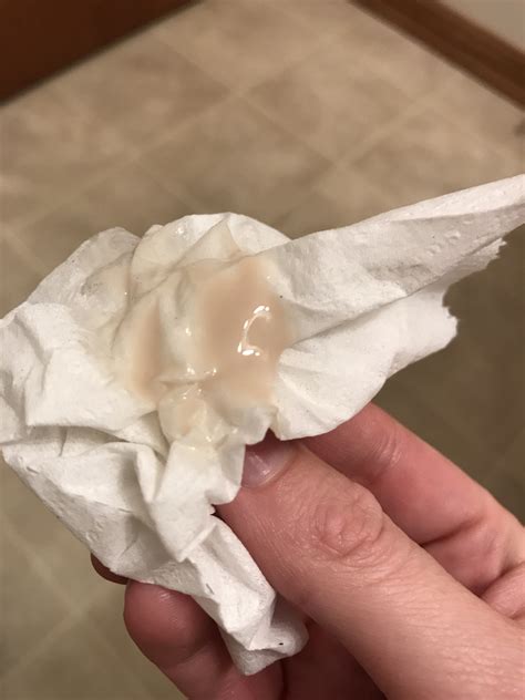 What Does Water Leaking During Pregnancy Look Like at Jack Radcliffe blog