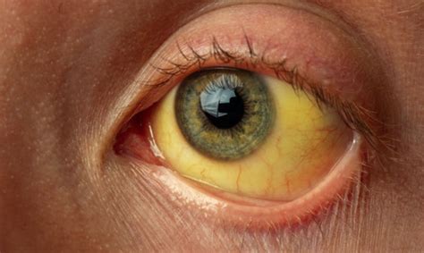 Ojo y Enfermedades Sistemicas — ceoval