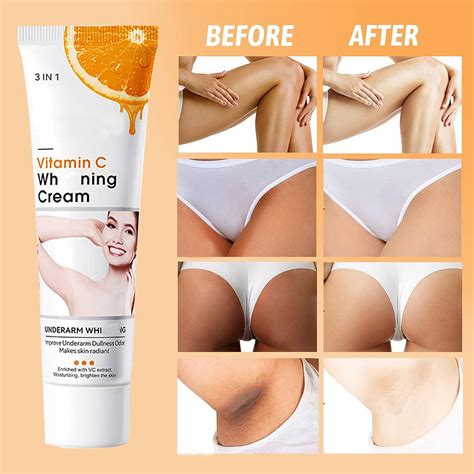 Dark Spot Corrector Cream for Inner Thighs, Legs, Underarms & Knees ...