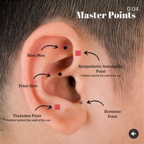 Master Points - @seededearseeds | Acupressure treatment, Acupressure therapy, Ear reflexology