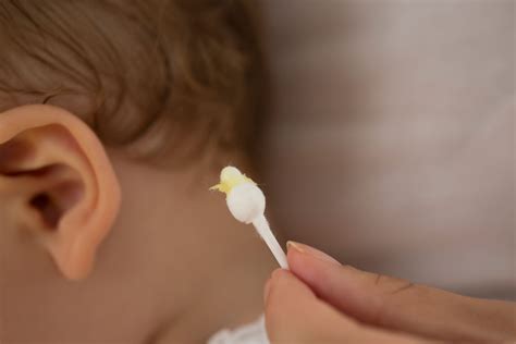 How To Remove Ear Wax With A Qtip at Madeleine Darbyshire blog
