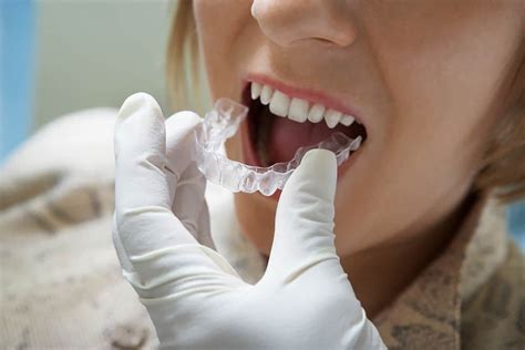 The Effectiveness of Occlusal Splints for Sleep Bruxism. Mouth Guards & Bruxism Splints to Stop ...