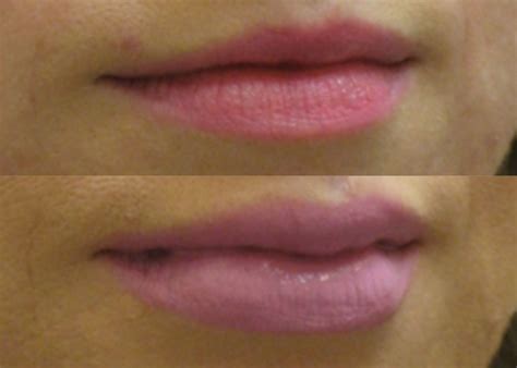 Lips Medical Term at Pearl Brandon blog