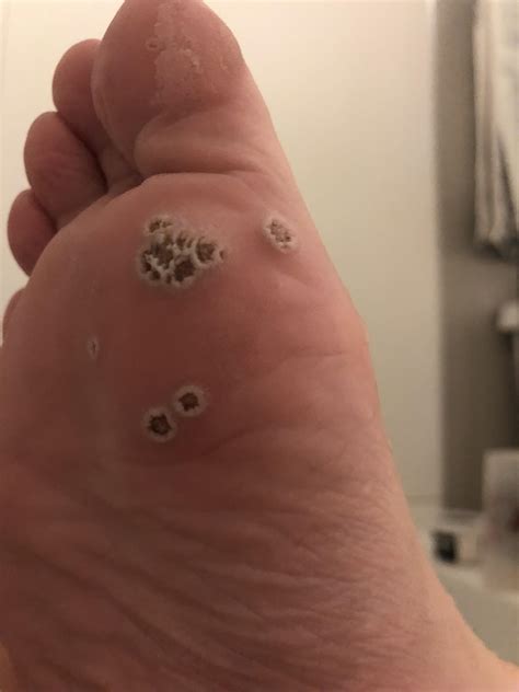 608 best r/gross images on Pholder | Look at the Image and Think of the ...