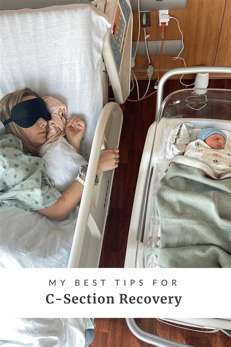 My best c section recovery tips – Artofit