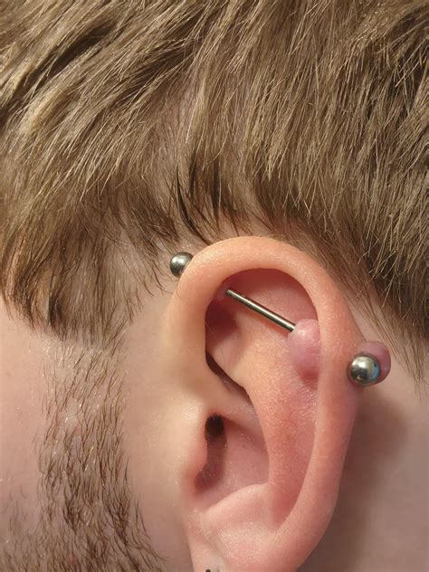 nipple piercing irritation bump : r/PiercingAdvice