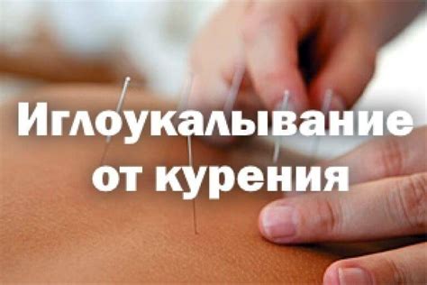 Иглоукалывание от пьянства: что это, как проводится, когда назначают ...