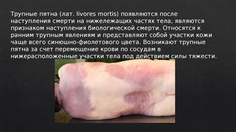 Ранние и поздние трупные явления - презентация онлайн