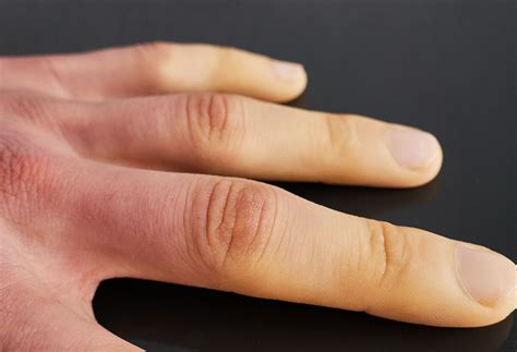 Poor Circulation Warning Signs To Watch For | The Well by Northwell