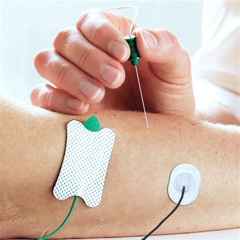 Электронейромиография (ЭНМГ), цены от 2310 руб. в Москве в Evolutis Clinic