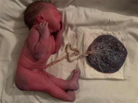 Frank Breech Birth Story in Seoul (First Time Mom)