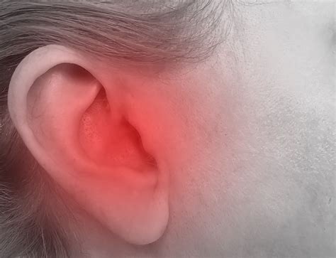 Earache In Left Ear : Ear Pain: Causes and Treatment Options - VVWSB