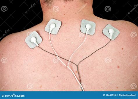 Tens Electrode Placement For Neck Pain at John Mallery blog