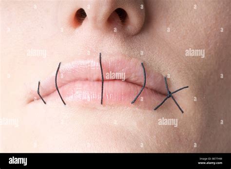 What Is Mouth Stitched Shut at Kristie Rhodes blog