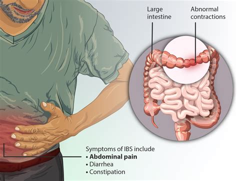 Does IBS Usually Cause Thin Narrow Poops? » Scary Symptoms