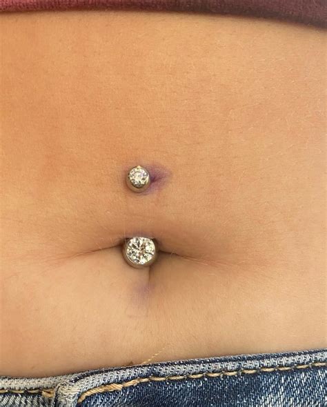 How To Treat A Belly Button Piercing Keloid? - Psycho Tats