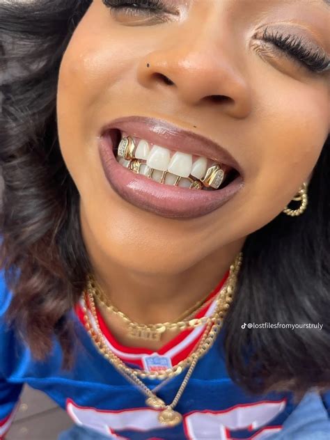 Pin by f•a•i•t•h on Pins•Pins•Pins | Gold teeth grills, Grills teeth ...