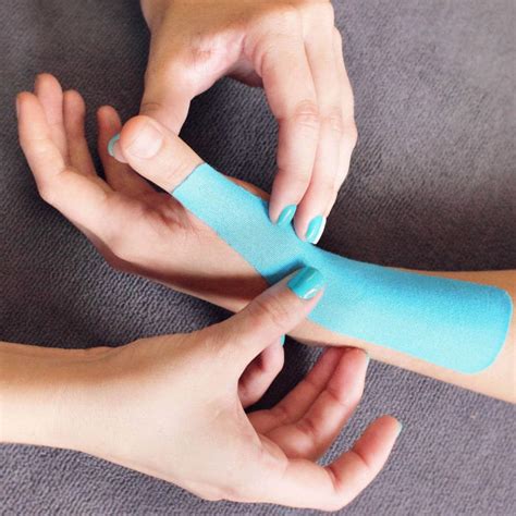 Colles fracture Treatment - Complex Wrist fracture treatment @Hand Therapy