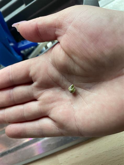 Theoretically wouldn’t heavy’s rib grow back? : r/tf2